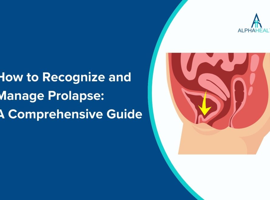 Prolapse